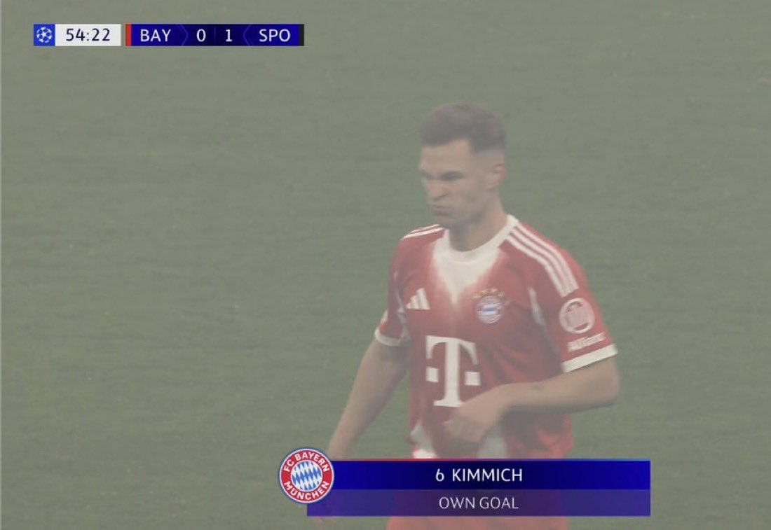 • صانع داعر 
• ممرر فاشل جدا
• اساس كل هدف في بايرن 
• خروج بالكره كوميدي 
• بالقدمين الله وكيلك لا احكي لك

من قدوم كيميتش لخط الوسط و البايرن يلعب بدون وسط .