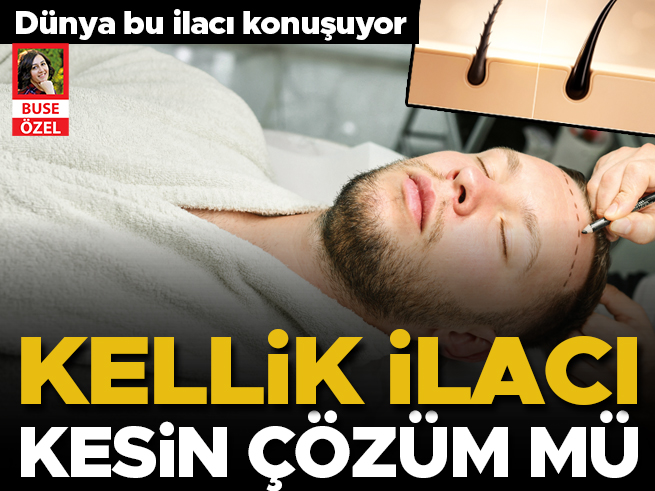 Dünya bu ilacı konuşuyor: Kelliğe merhem umudu
<a href="/buseozelll/">buse özel</a> 
hurriyet.com.tr/gundem/dunya-b…