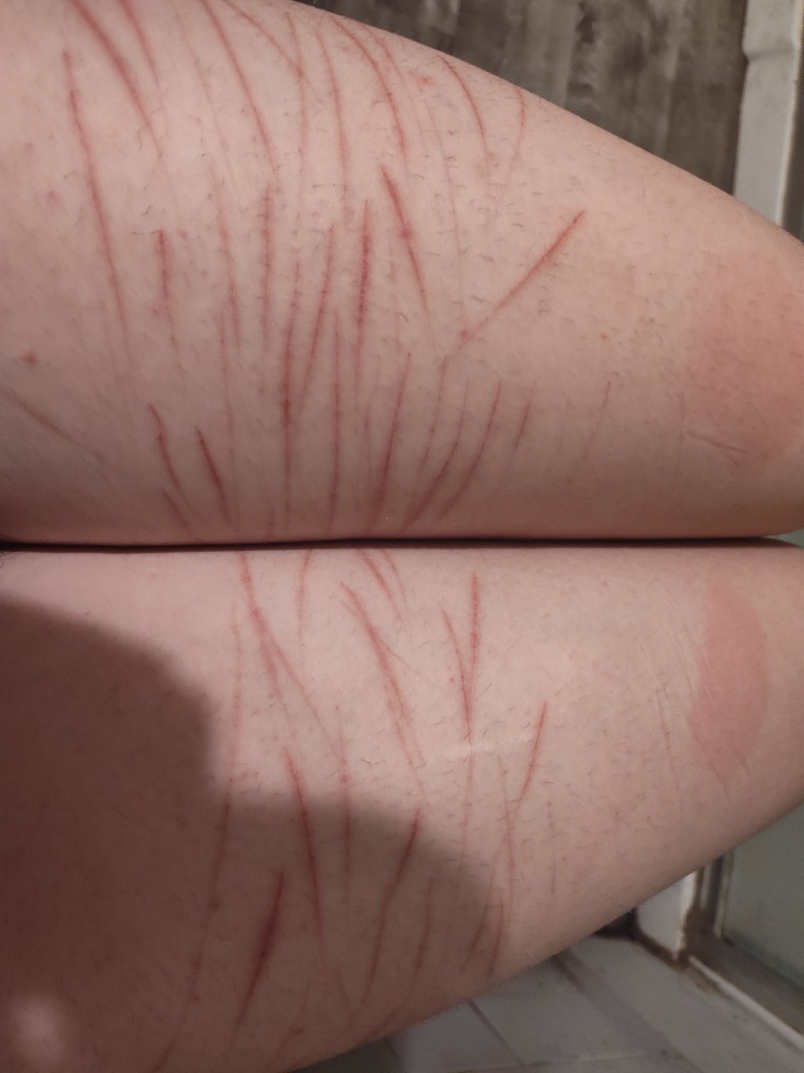 Yamazakura ✧ shtwt ⁠✧ tweet media