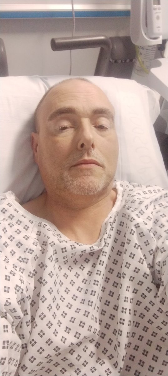 monkeyfun1001's tweet image. Unsure if anyone looks at my feed, but I came to X to cheer people up. But I've been so ill had to have emergency colonoscopy. So Crohn's disease, Primary Sclerosing Cholangitis (PSC) &amp;amp; now Hepatic Encephalopathy (HE). So what I'm saying is sorry for being slow with replies. 🤠🥴