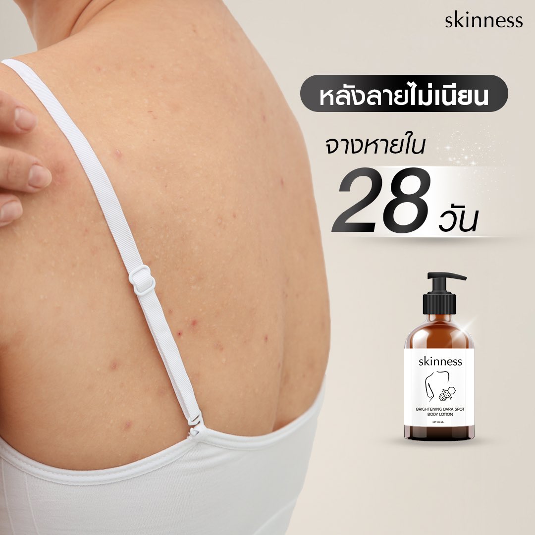 skinness official tweet media