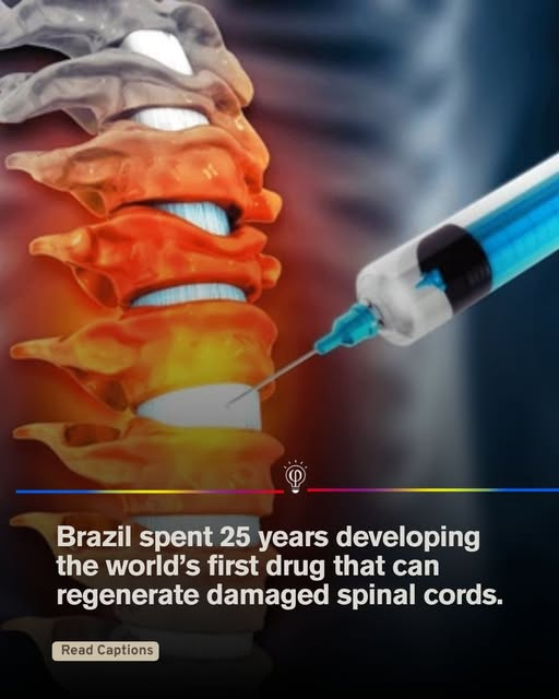 Rainmaker1973's tweet image. After 25 years of research, Brazilian scientists developed a drug capable of regenerating spinal cord tissue after severe injuries. 

The therapy stimulates axon regrowth and reduces scarring that typically prevents nerve recovery.

In preclinical trials, treated animals regained…