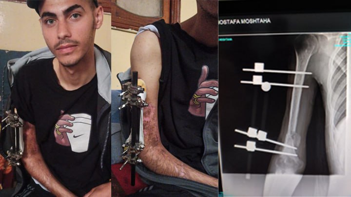 mostafa ahmed From Gaza🍉🇵🇸 tweet media