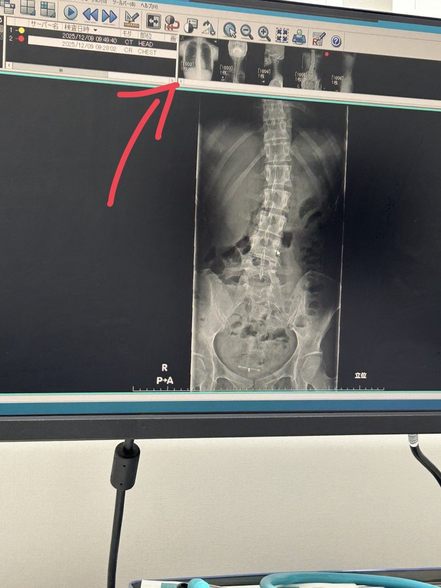 おみぃ子 (@mii19940705mii) / Posts / X