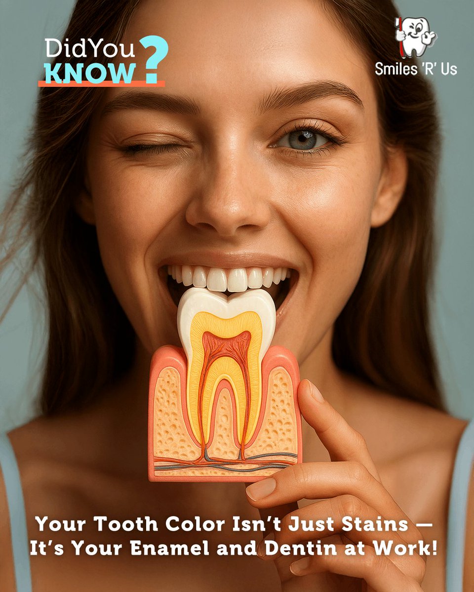 DrPinali's tweet image. 🦷✨ Did You Know? 🎨

Your #Tooth Color Isn’t Just Stains — It’s Your #Enamel and Dentin at Work! 😮✨

Thicker enamel looks whiter, thinner shows more #dentin 🧬😁.

Good #OralCare still matters: #brush daily 🪥, limit acids 🥤, and get regular cleanings.

#DidYouKnow