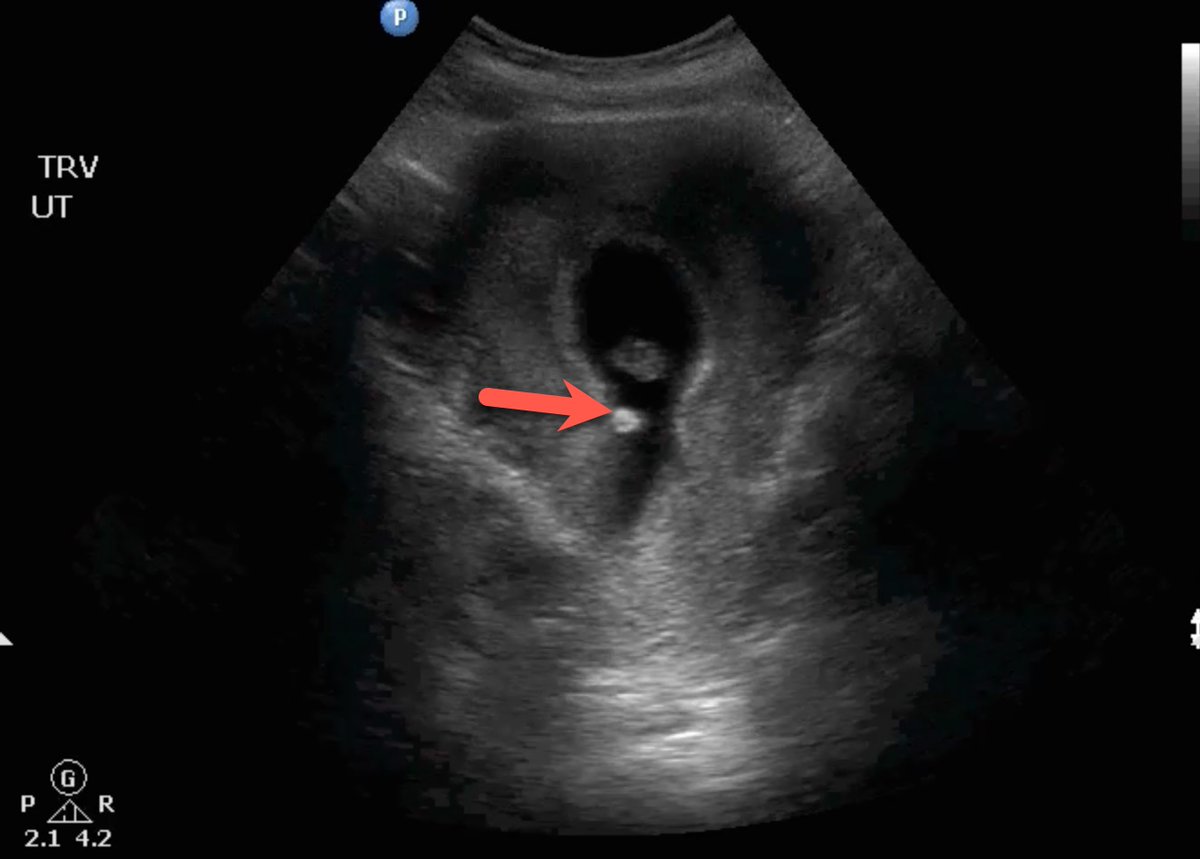 POCUS Focused tweet media