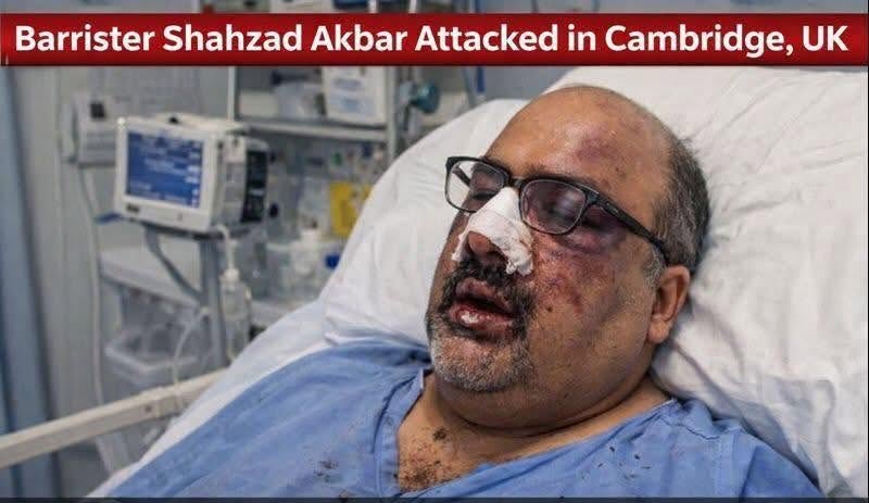 noreen_khanum's tweet photo. We strongly condemn the brutal attack on Barrister Shahzad Akbar in London.
@ShazadAkbar https://t.co/MTkx8LnHG6