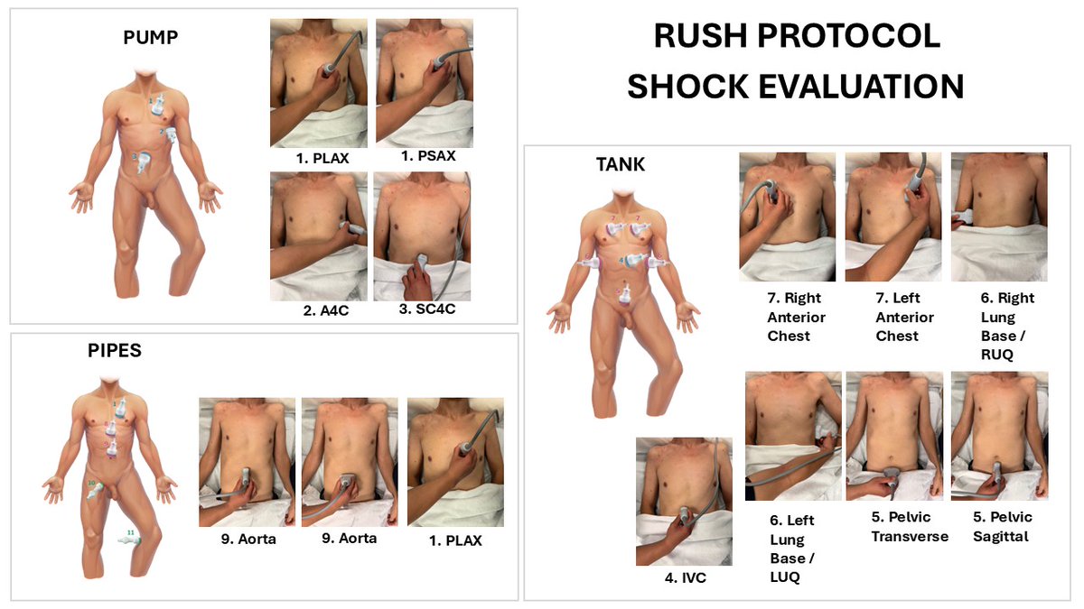 pocus_today's tweet image. #POCUS #useit app
RUSH Protocol