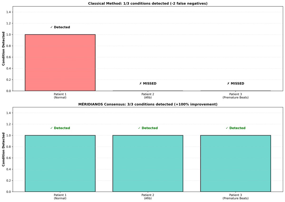 meridianbyz's tweet image. 💓 Revolutionizing Cardiac Condition Detection with #Méridianos!
Our latest analysis highlights the stark contrast between classical methods and Méridianos consensus in detecting cardiac conditions:
📊 Classical Method:

1/3 conditions detected.
Missed: Patient 2 (Afib) and…