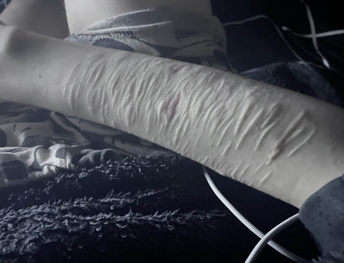 implicitcrulety's tweet image. I hate my scars