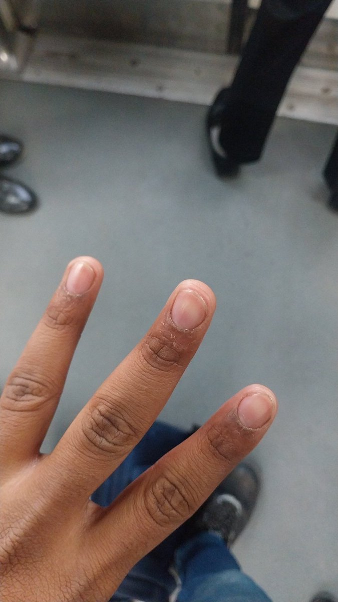 Ayush 🐳 $BLUAI tweet media