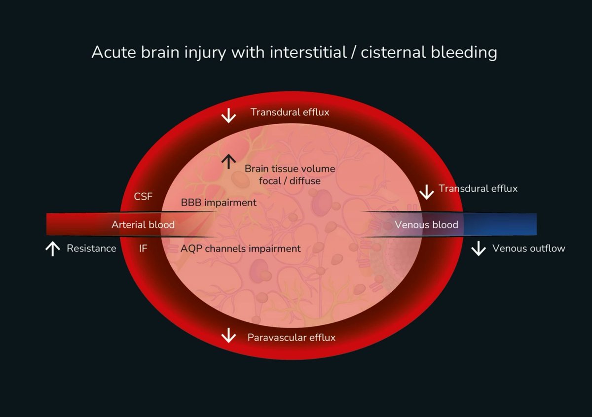 CritCareReviews's tweet image. Today's Paper of the Day is:

Monro-Kellie 4.0: moving from intracranial pressure to intracranial dynamics

criticalcarereviews.com/latest-evidenc…

Join us to read 1 paper per day and stay up-to-date as we cover the spectrum of critical care across 2025