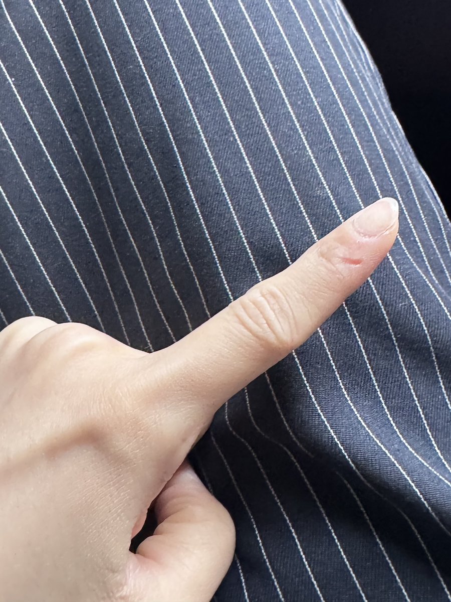 หนูเกิดอุบัติเหตุนิดหน่อย ขอโทษอัลกี้ที่ชิงเต่าล่วงหน้าเลยนะคะ มืออาจจะไม่ค่อยสวย🥹🙏🏻