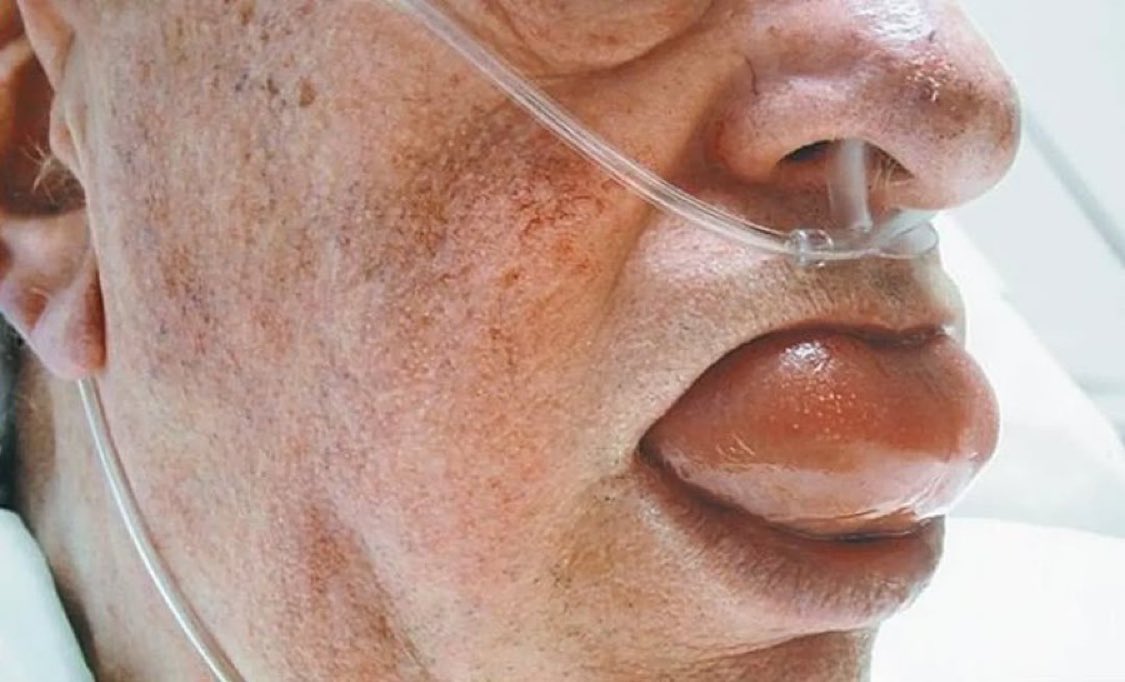 Dr Honey choudhary 🩺 tweet media