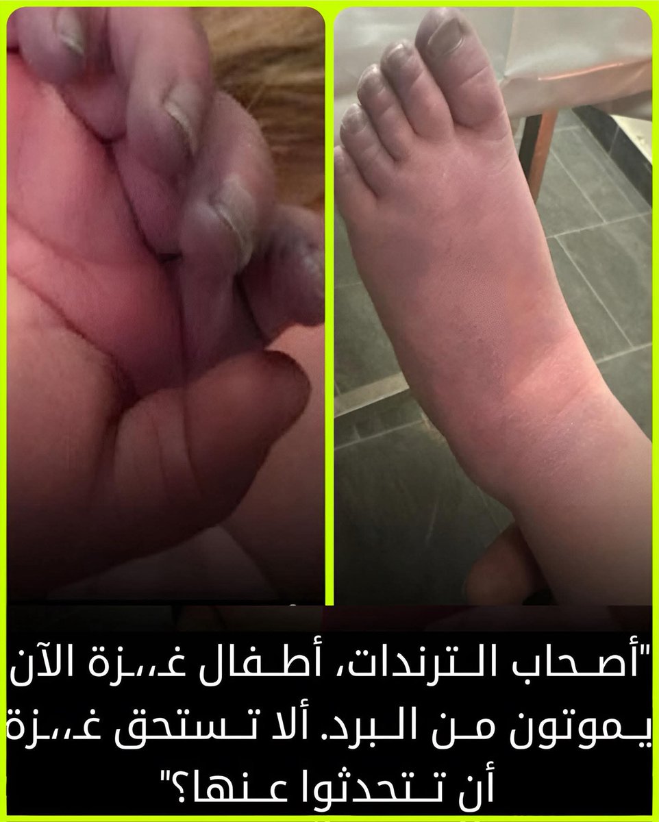 بينما العرب منشغلون بكرة القدم والاحتفالات،
يتجمّد أطفال غزة من البرد القارس في خيام مهترئة تكاد لا تحميهم شيئًا.
تحدثوا عنهم،
فالصمت أمام معاناتهم خيانة للإنسانية.