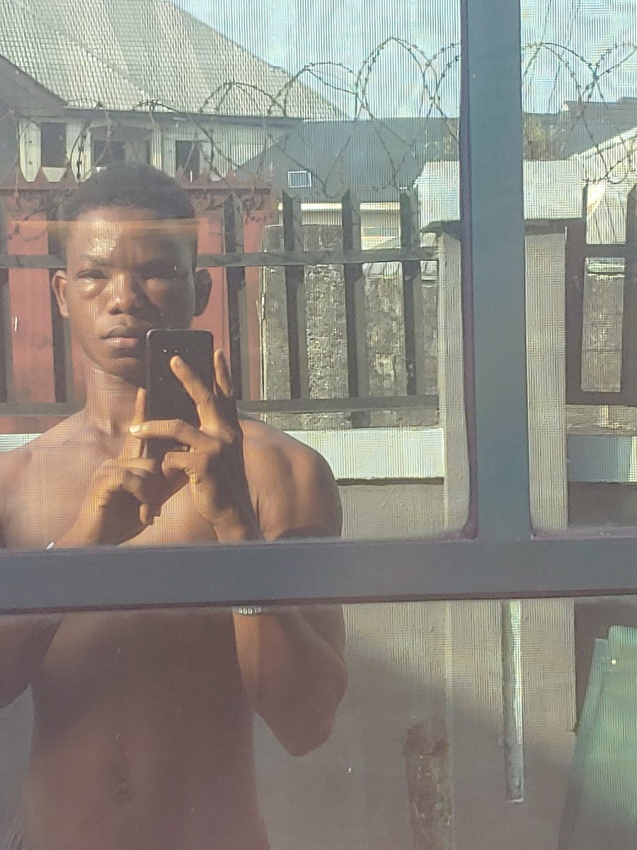 called_eben's tweet image. Taking a short break from posting 😤👀 eye problem showed up unannounced 😂 If it’s not serious, don’t worry—I’ll be back posting.