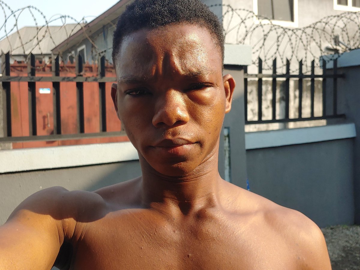 called_eben's tweet image. Taking a short break from posting 😤👀 eye problem showed up unannounced 😂 If it’s not serious, don’t worry—I’ll be back posting.