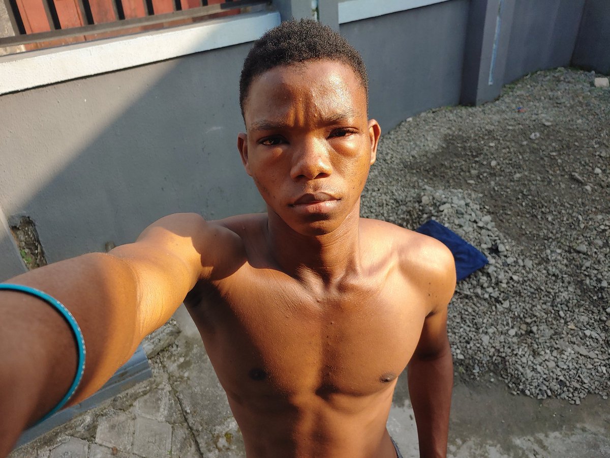 called_eben's tweet image. Taking a short break from posting 😤👀 eye problem showed up unannounced 😂 If it’s not serious, don’t worry—I’ll be back posting.