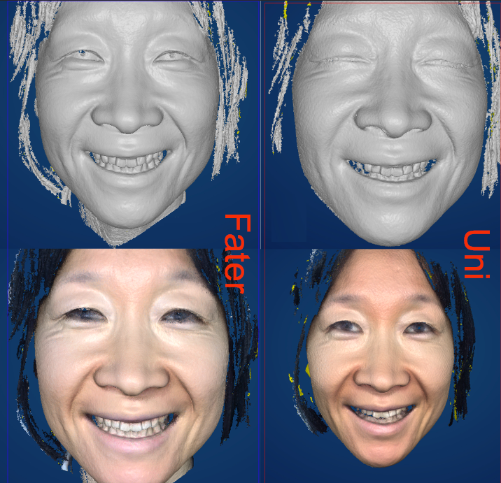 LanziLuo's tweet image. Which one do you prefer?

 Nancy (Lanzi Luo)
 📱 : +86-15652619522
 📧 : nancy.luo@thunk3d.com / nancy.thunk3d@gmail.com

#facebow #MODJAW #Zebris #SDIMATRIX #bodyscan #ArcherS #Metismile #Rayface #intraoralscanner #Facescan #EXOCAD #3Shape #fullarchimplant #thunk3d #shining