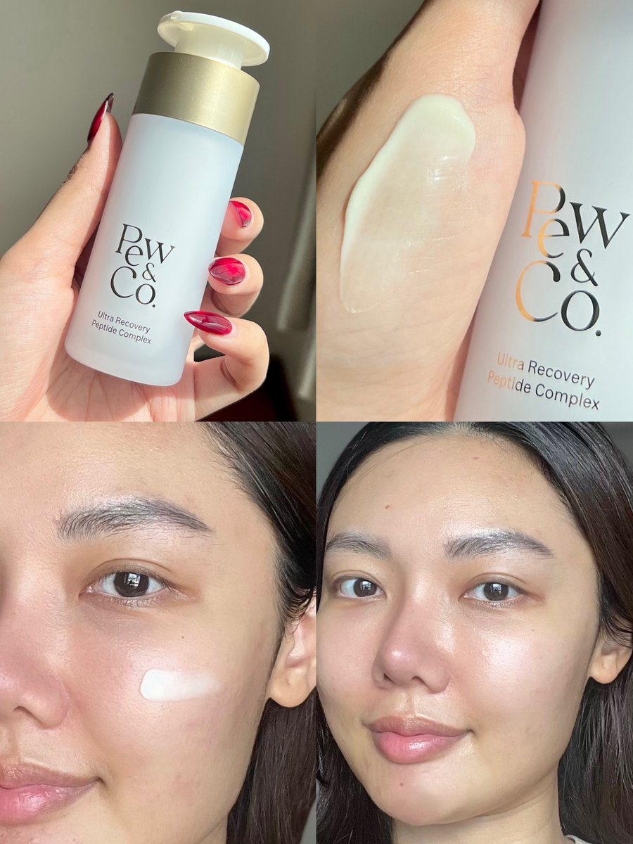 plengssp's tweet image. เป็นมอยส์ที่เหมาะกับผิวหลังทำเลเซอร์สุดๆ Pew&amp;amp;Co จุดเด่นคือมี egf ช่วยสมานแผลและกระตุ้นคอลลาเจน ทำงานร่วมกับ gold bonded vitaminC ที่อ่อนโยนมาก ยิ่งใช้หลังทำ pico คือแผลหายไวมาก และขวดเป็นสุญญากาศ มั่นใจได้ว่าทุกหยดสะอาดปลอดเชื้อ เหมาะกับใช้ช่วงผิวมีแผล ตอนนี้ใช้เป็น daily use…