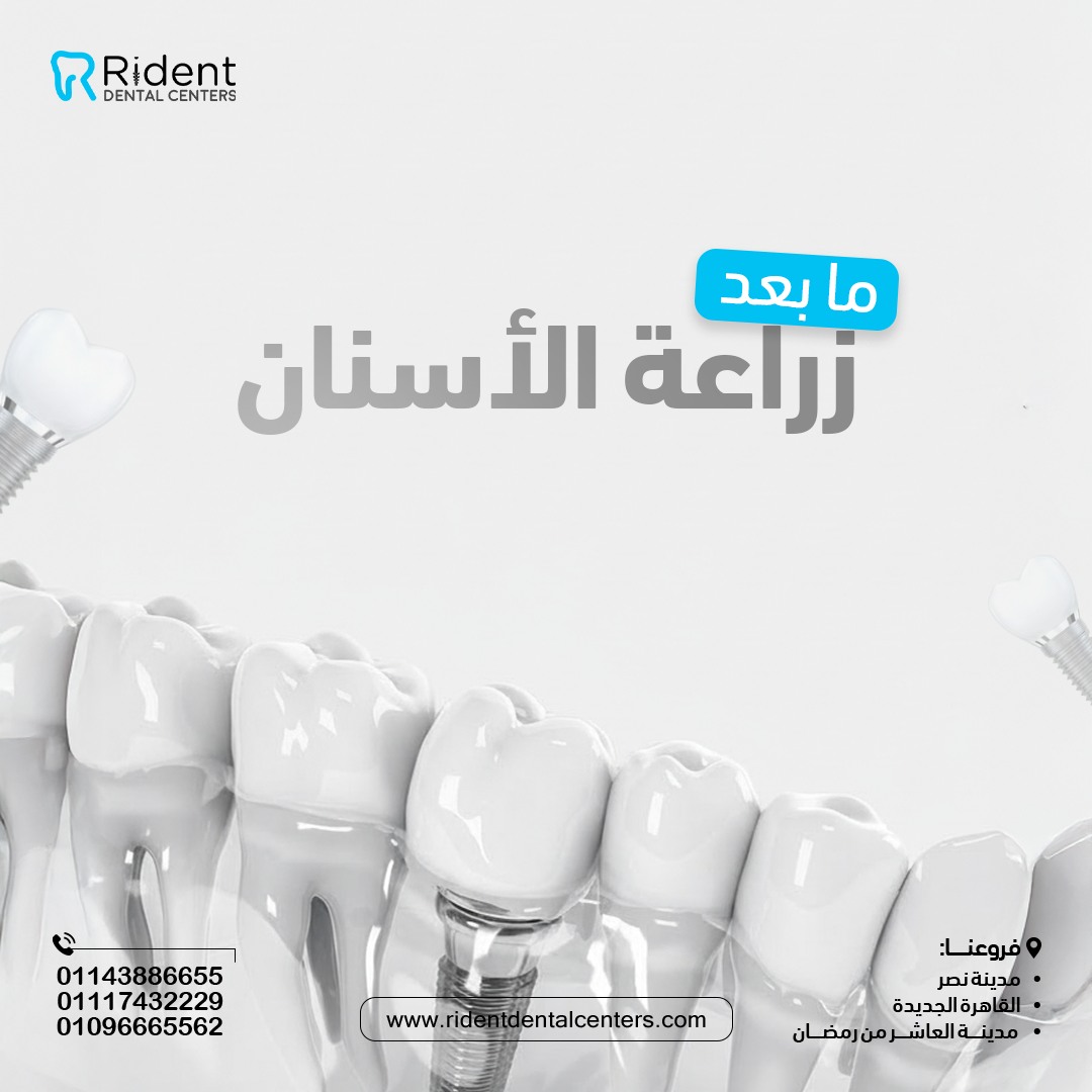نجاح زراعة الأسنان يبدأ بعد الإجراء 
التزم بالنظافة + المتابعة الدورية.
في #مراكز_رايدنت بنتابعك خطوة بخطوة وفريقنا بيرد طول اليوم.
مستني إيه؟ احجز: 01143886655 | 01117432229 | 01096665562
فروعنا: مدينة نصر | القاهرة الجديدة | العاشر من رمضان
#زراعة_الأسنان #هوليود_سمايل