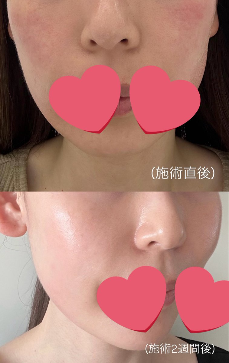 𝖽𝗈𝗈𝗇𝖺 ෆ tweet media