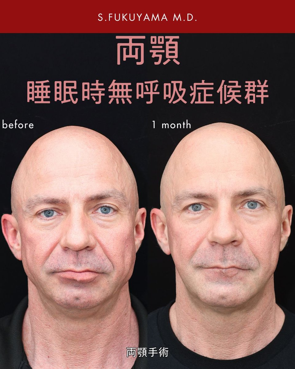 kotsukotsukiri's tweet image. 美しさ、カッコ良さって顔を小さくすればいいってもんじゃないと私は思います。