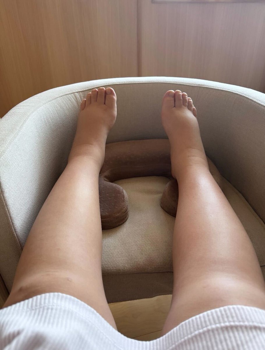 yukos_kawaii's tweet photo. 載せるの迷ったけど、いいや😂👊！
産後人生初の80kgまで行き、心不全もあり呼吸も苦しく、肌も髪もボロボロ。鏡の自分を見る度に「誰😭？」と大泣き...でしたが、ここまで来たらやるしかねえ🔥！と、筋トレ＆食事制限＆有酸素で健康的に減量できてます！！自信取り戻せてきた！ https://t.co/8tbBynLfsw