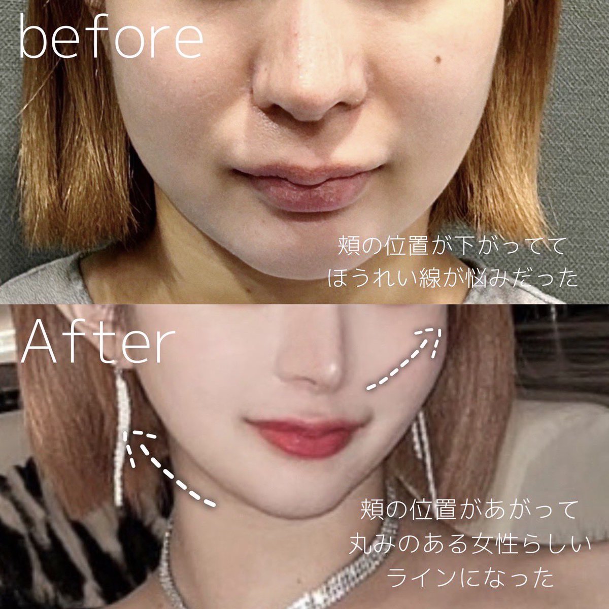 𝙃𝙞𝙣𝙖 (@b55fq) / Posts / X