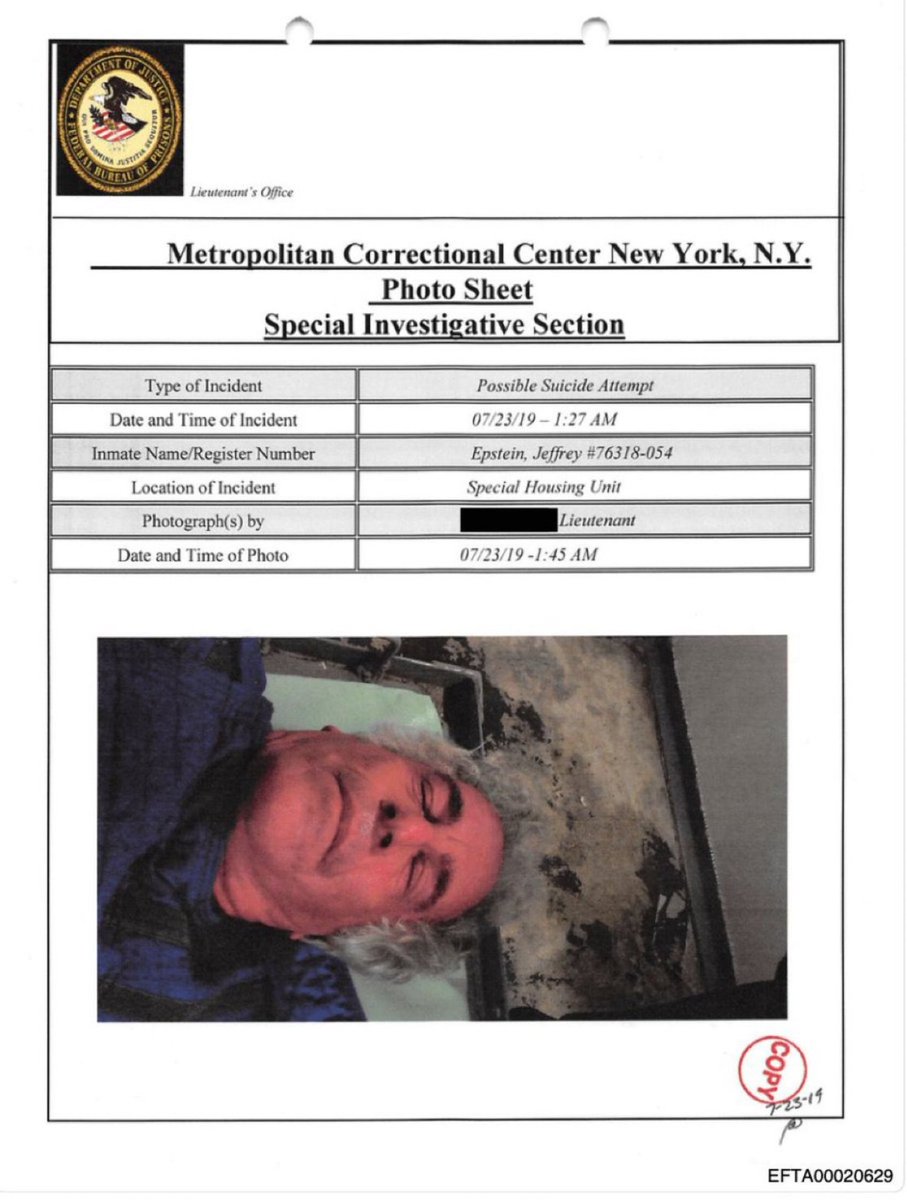 MarioNawfal's tweet image. 🚨🇺🇸 NEW EPSTEIN FILES: EPSTEIN FEARED RETURNING TO CELL WHERE HE GOT STRANGLED - SAID “I DON’T KNOW WHAT HAPPENED”

On July 23, 2019, Jeffrey Epstein was found unconscious in his cell at MCC New York with neck injuries, snoring loudly and unresponsive.

Medical staff documented…