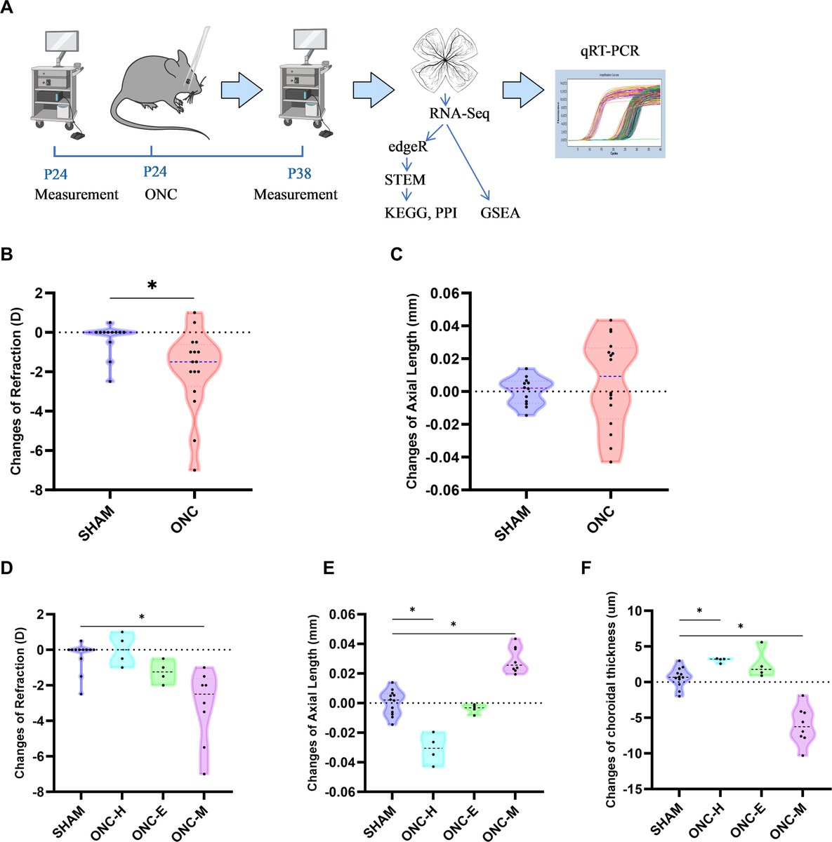 AAOjournal's tweet image. The Effect of Optic Nerve Crush on Lens-Induced Myopia in Mice
ow.ly/uYMZ50XxAcf
#ophthalmology #myopia