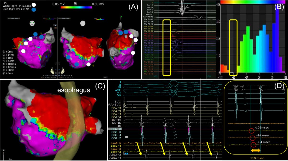 Heart Rhythm Case Reports tweet media