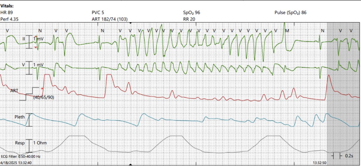 Heart Rhythm Case Reports tweet media