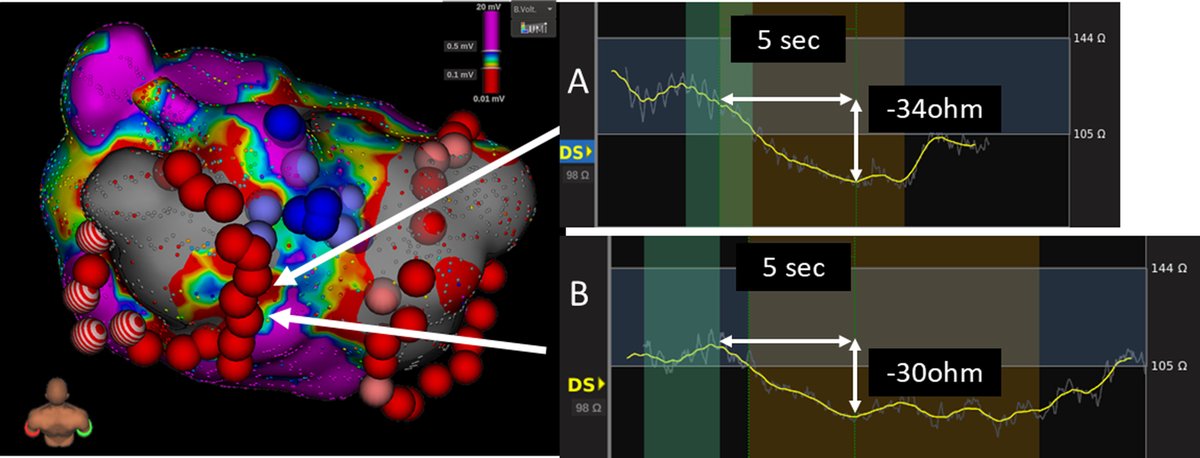 Heart Rhythm Case Reports tweet media