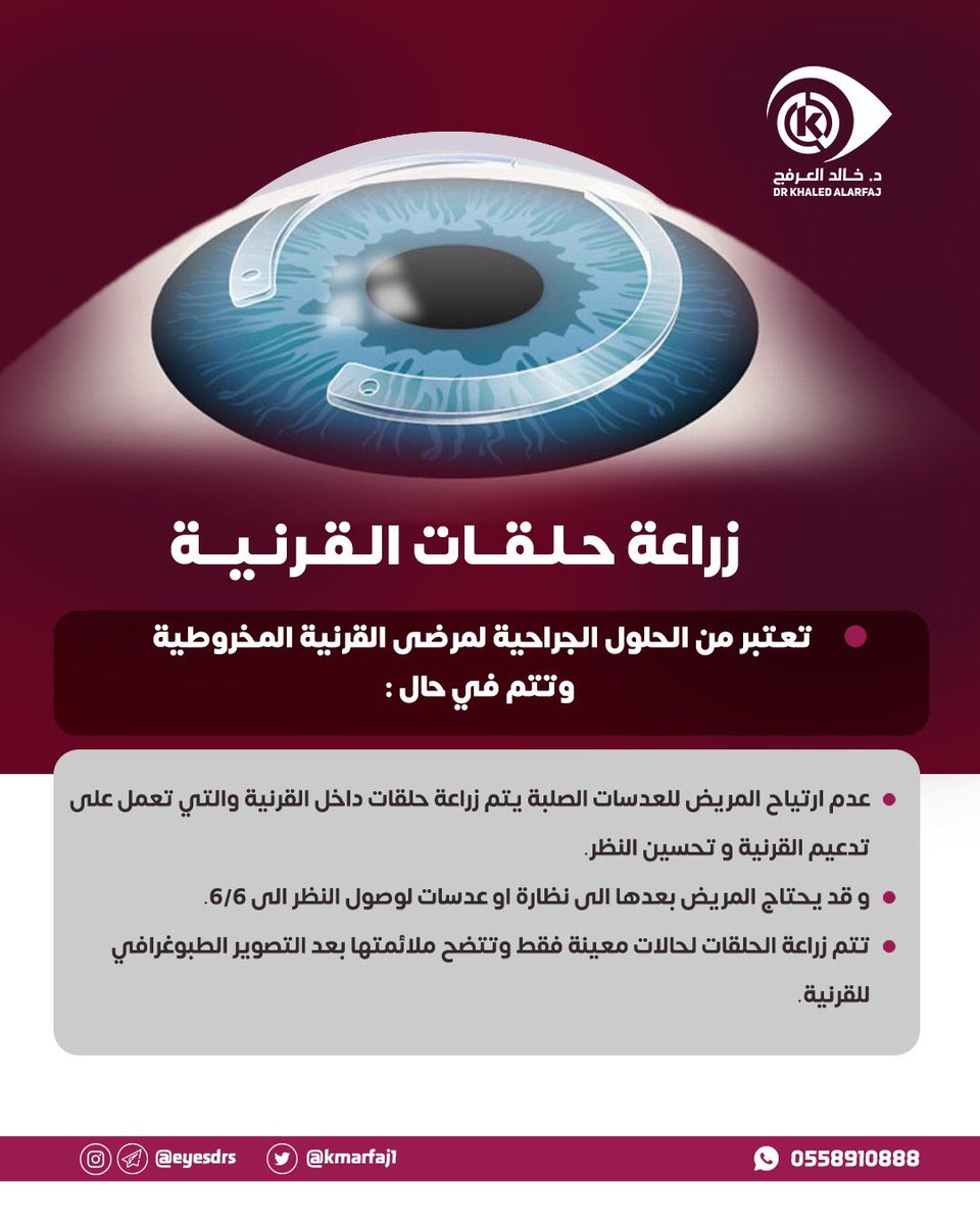 بصير tweet media