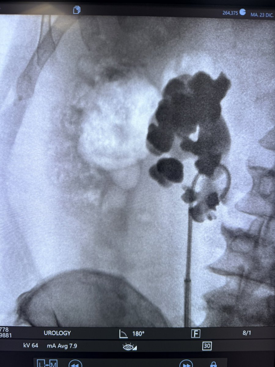 MD Braulio O. Manzo tweet media