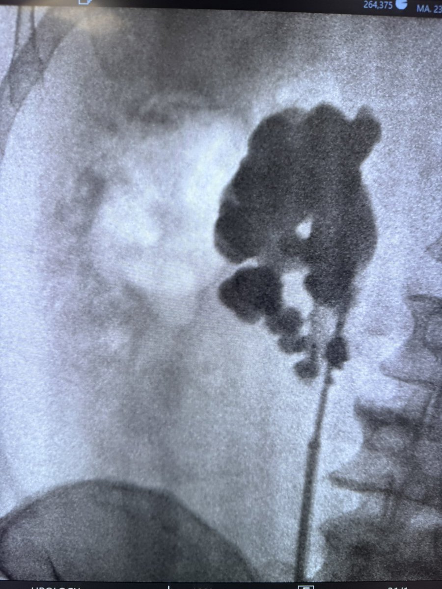 MD Braulio O. Manzo tweet media