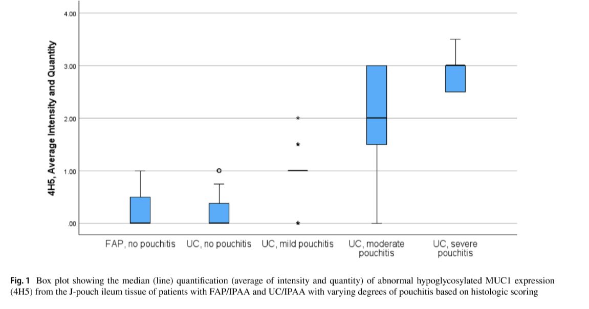 JHashashMD's tweet photo. Kudos to 🌟 @CarolineOlsonMD and our 💫 #MUC1 research team for investigating patterns of MUC1 expression in #pouchitis
🔥🔥Just published in @DDS_journal
Thanks to @MayoGIMFL for supporting this work 📝
https://t.co/t707ZzLgm0 https://t.co/mUAlU7JAa3