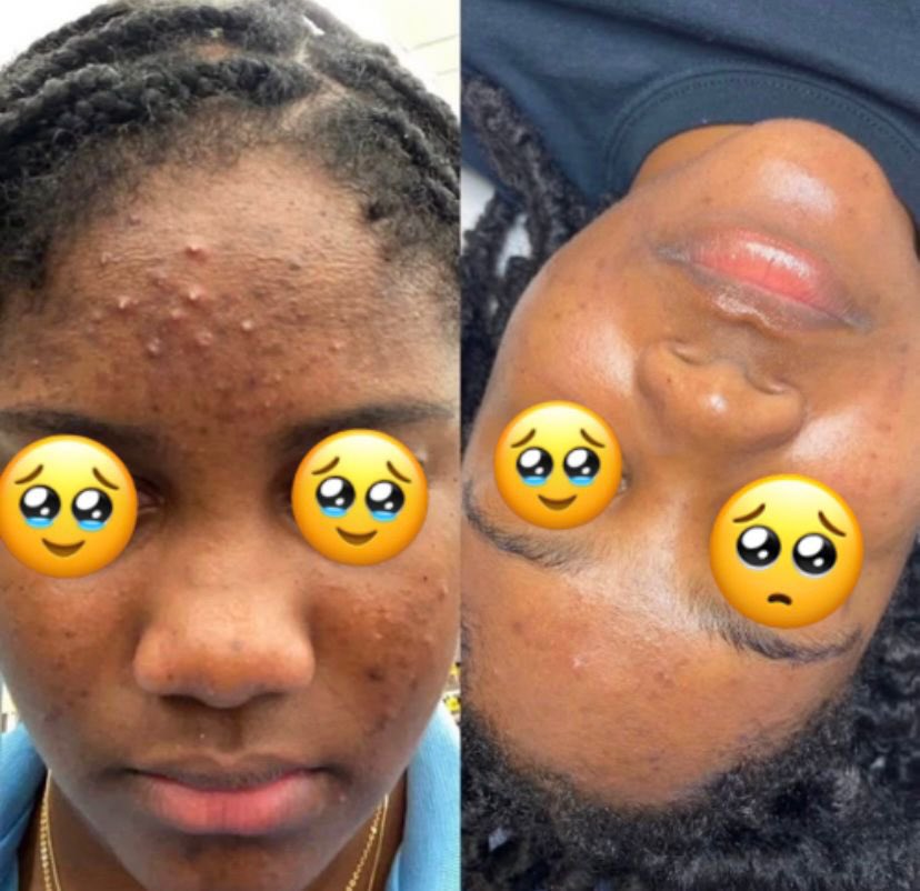 🌿 GRANDE ANNONCE 🌿
Je suis heureuse de vous présenter La Fortune Skincare, ma boutique en ligne 
🧼 Savon noir authentique du Ghana
✨ Aide à éliminer les imperfections.
💰 Prix : 2000 F
🚚 Livraison à Douala
📦 Expédition possible pour Yaoundé
📞 691 222 455.
🔁 RT🫶🏿