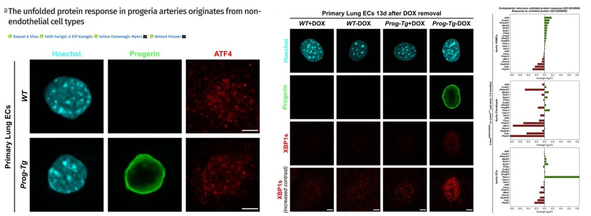 HaoYin20's tweet photo. #HutchinsonGilfordProgeriaSyndrome
Intriguing 🐭data showing that Progerin-induced #ERStress #UnfoledProteinResponse in Aorta is NOT EC-origin
Evidence from
1⃣Cdh5-tTA::tetop-LA G608G 🐭
3.5 or 6 mo, endothelial progerin transgene, primary lung & heart EC & aortic tissue
2⃣Lmna G609G knockin 🐭
3.5 mo, re-analysis of scRNAseq Aorta
Love to see more in situ aortic endothelial data
@Selma_OsMyers @LSAjournal 2025
https://t.co/u11vu06fiB