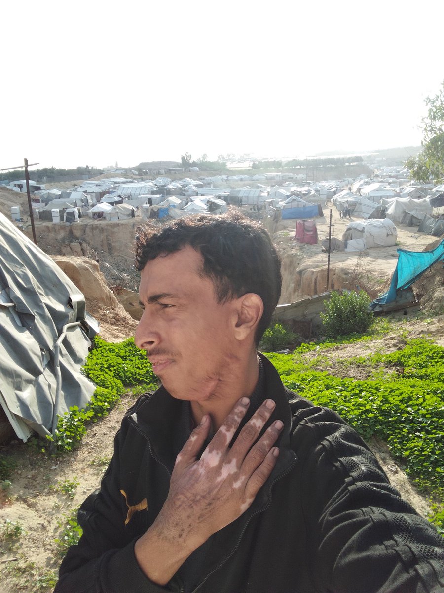 BahaaEdani's tweet image. I appeal to you once again I'm just trying to survive😔

If you’re scrolling PLEASE leave a dot  it's just a dot.💔🙏🏽😥
gofund.me/fc004994