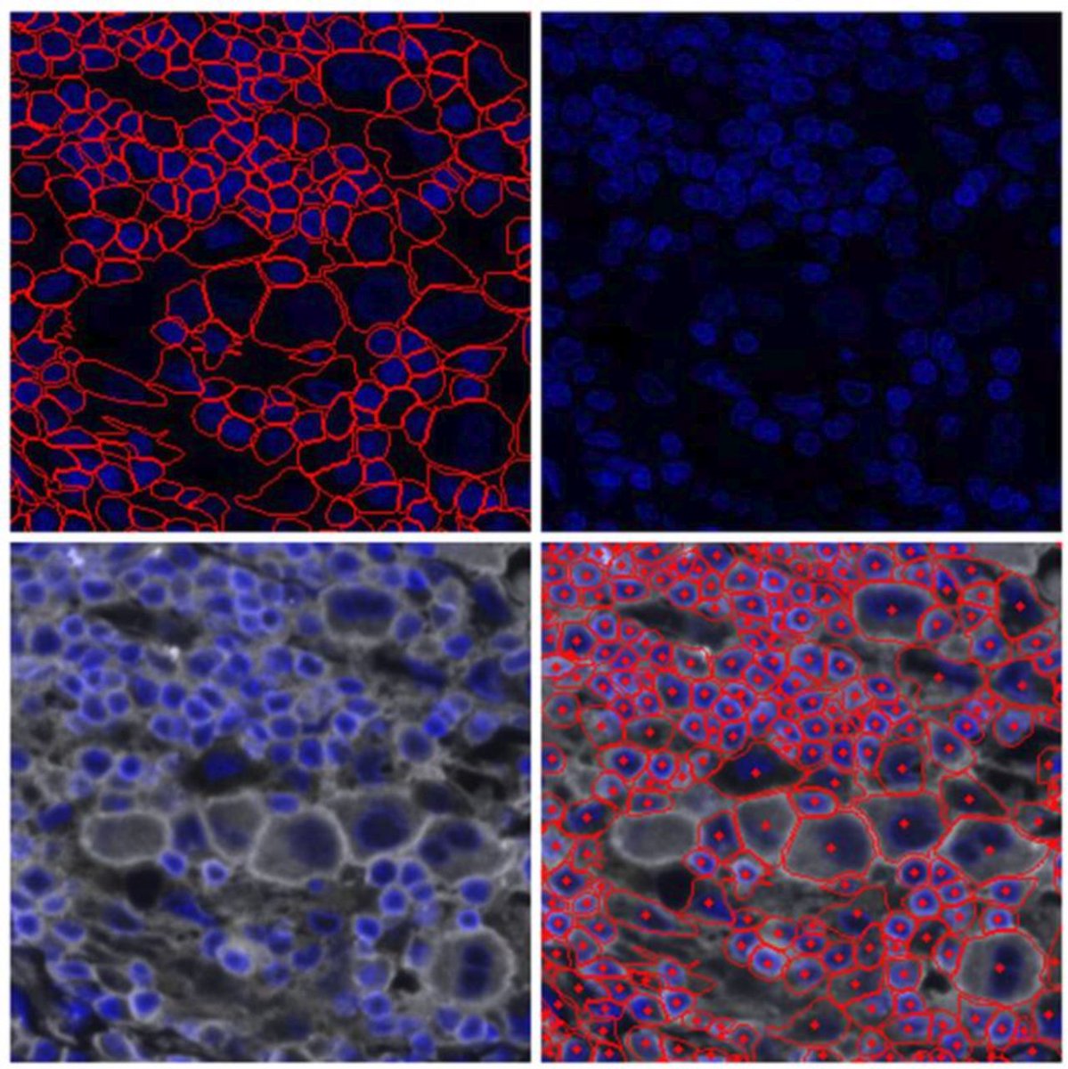 jitcancer's tweet photo. New #JITC position article and guideline: Society for Immunotherapy of Cancer: Standards for Reporting of Multiplex Immunohistochemistry/Immunofluorescence Assays (STORMI)
https://t.co/lu7wNKBYJq @JoeYeong @ColtEgelston @RongFan8 @BernardAFox @MarwitzS https://t.co/TjY2APvqOl