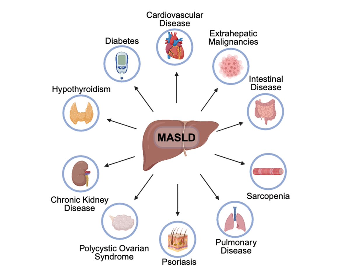 Extrahepatic manifestations of #MASLD.
oaepublish.com/articles/mtod.…