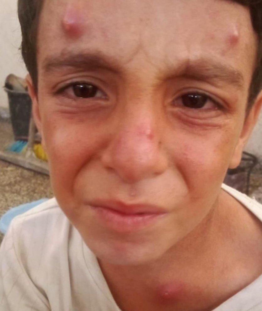 RozeatG's tweet image. 💔Adam is suffering from a contagious rash due to the pollution dirt and dust in his environment His condition is worsening day by dayand I can't afford treatment or cleaning supplies Please help me so I can treat him🙏

 Even a dot would be appreciated
chuffed.org/project/137260…