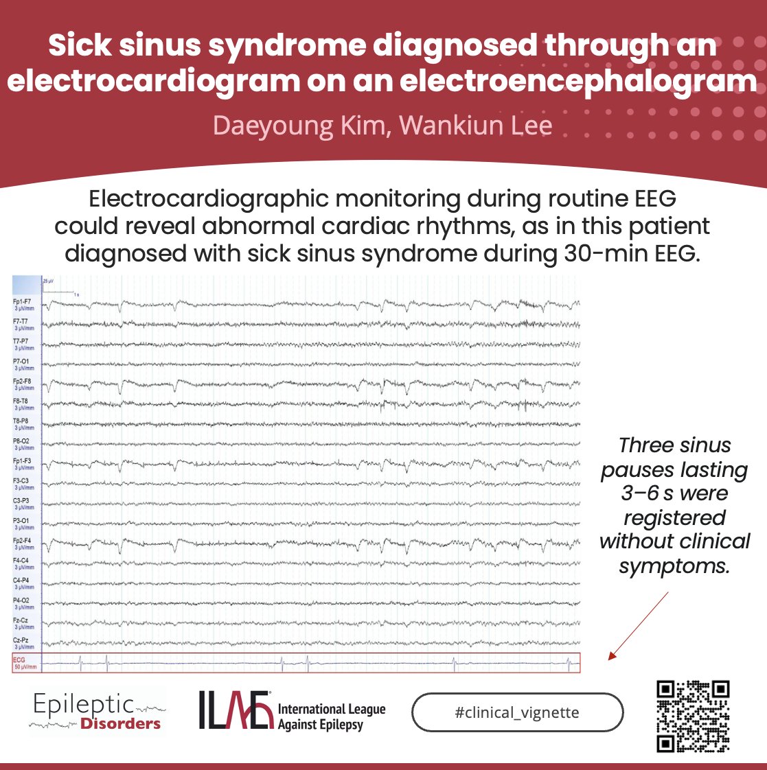 Epileptic Disorders tweet media