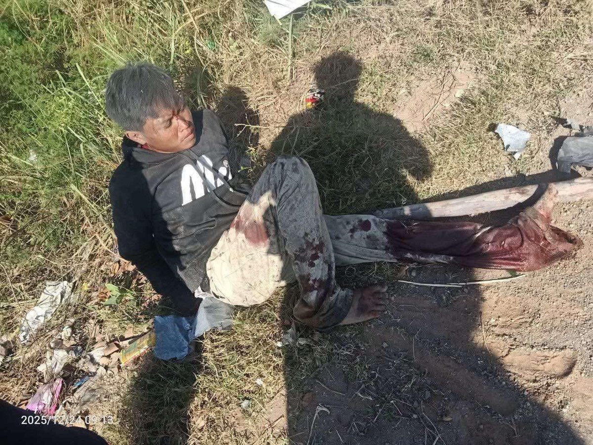 Chhun_sc's tweet photo. On 24 Dec 25, round 9am, Thailand used F16 more than 100km inside Battambang province, Cambodia, bombing on civilian. Now I condemn both Thailand and USA for allowing such nations use US F16 air strikes against civilians. https://t.co/bQnWMr9zgf