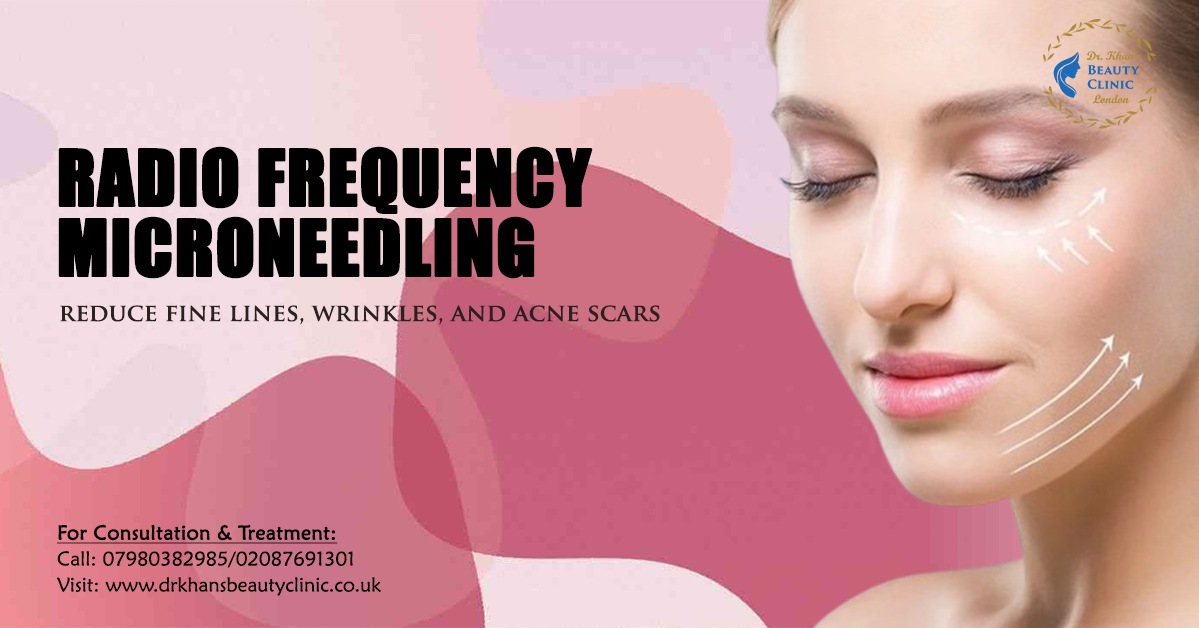 DrKhansBeautyC1's tweet image. #Microneedling is a great way to improve #skin texture &amp;amp; appearance. It involves tiny needles that stimulate #collagen production, reduce fine lines, #wrinkles &amp;amp; #acne #scars. Results are usually noticeable after a few sessions.

Book now:
☎️07980382985
🌐drkhansbeautyclinic.co.uk/rf-gold-plated…