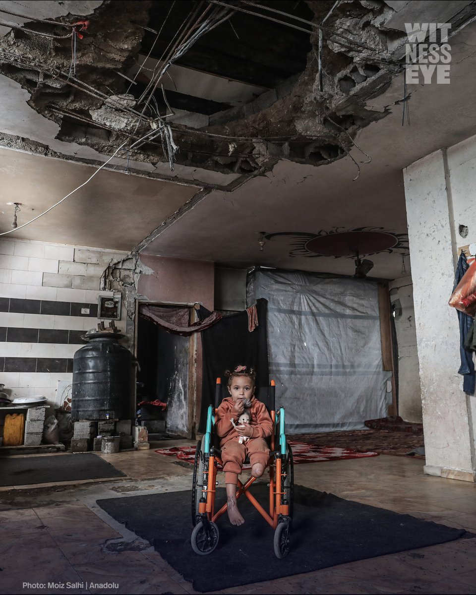 WitnessEye_Ch's tweet image. 🟡 4-year-old Rawan al-Masri lost one leg due to Israeli attacks and forced to displaced with her family to the Bureij Refugee Camp in Deir al-Balah, Gaza. When the house they took shelter in was hit, she lost several family members, her leg was amputated, and her father lost an…
