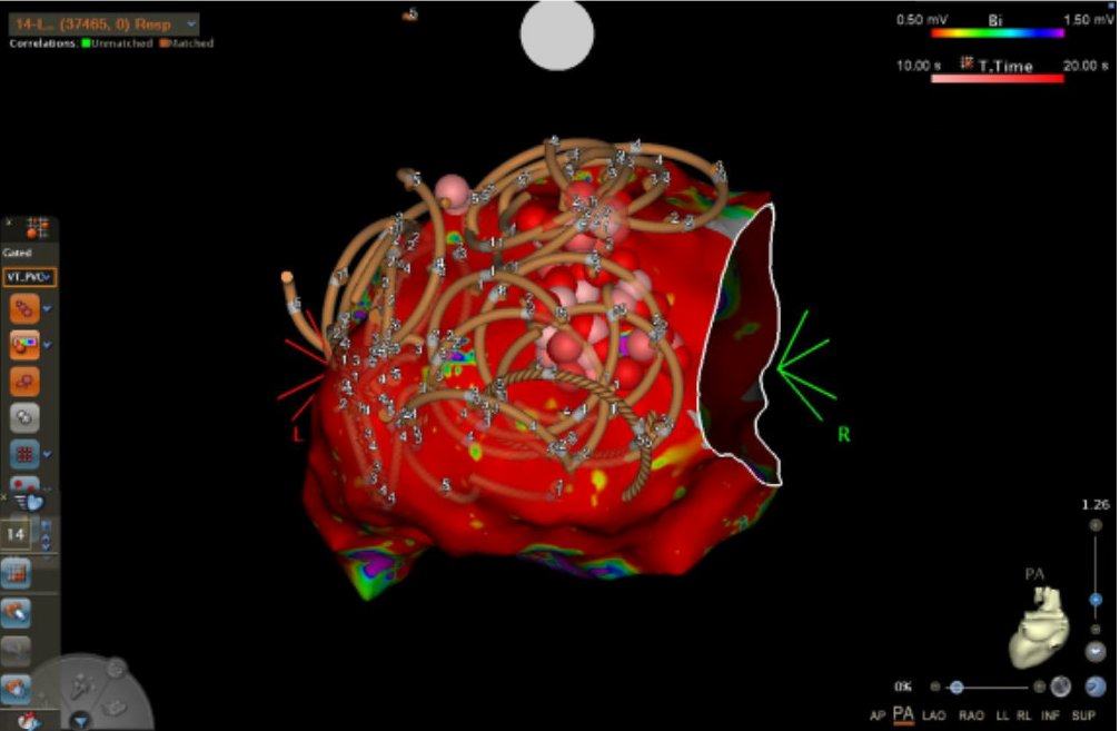 Madhu Reddy tweet media