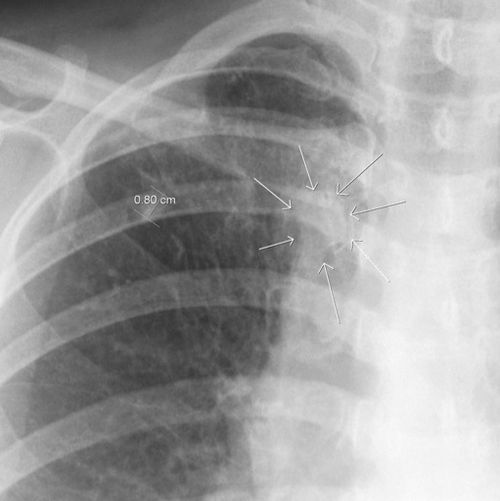 CardiovascularCorner tweet media